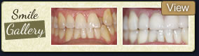 smile galley dentist woodland hills
