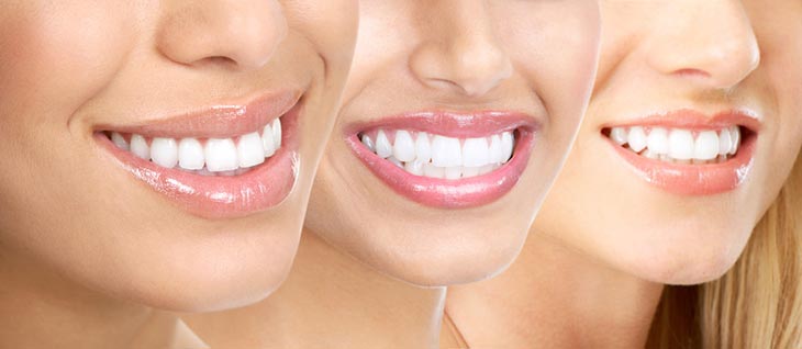 Dr. ford woodland hills dentist #9
