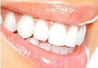 laser dentistry in woodland hills