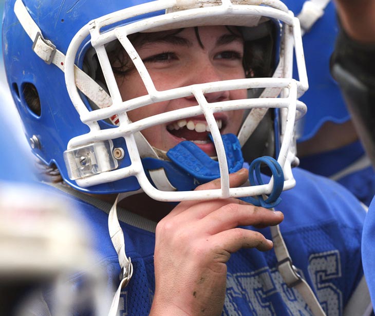 Sport Mouthguards in Wooland Hills